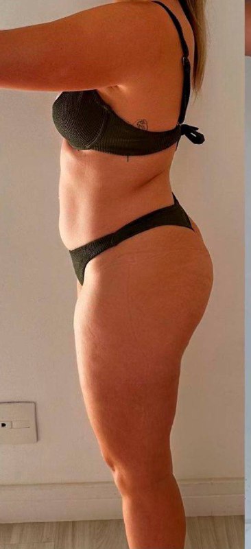 Antes